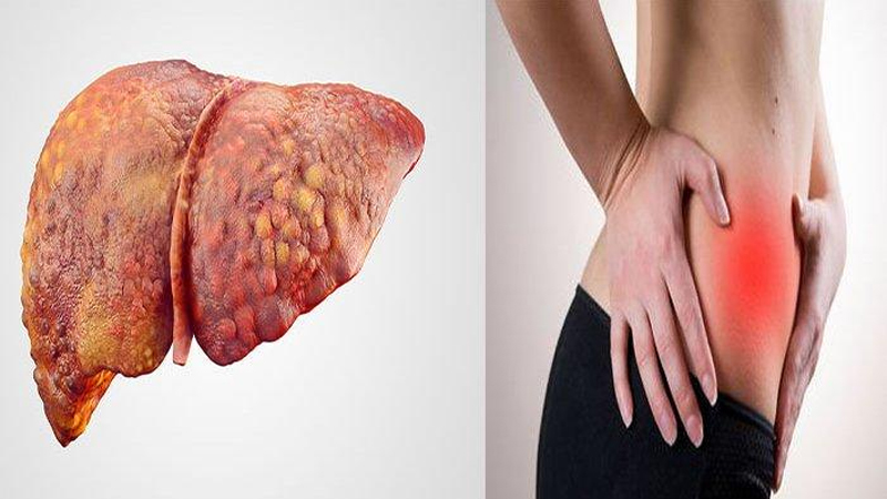 Penyakit Liver: Gejala dan Tips Kesehatan dari PAFI Pasuruan